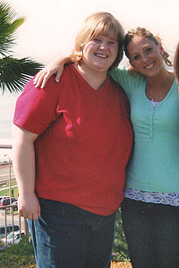 Patient Lori Before Surgery