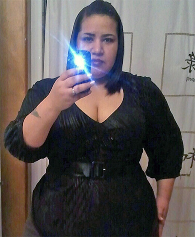*Results may vary, Heather R., Salem, OR. Patient Heather Before Surgery